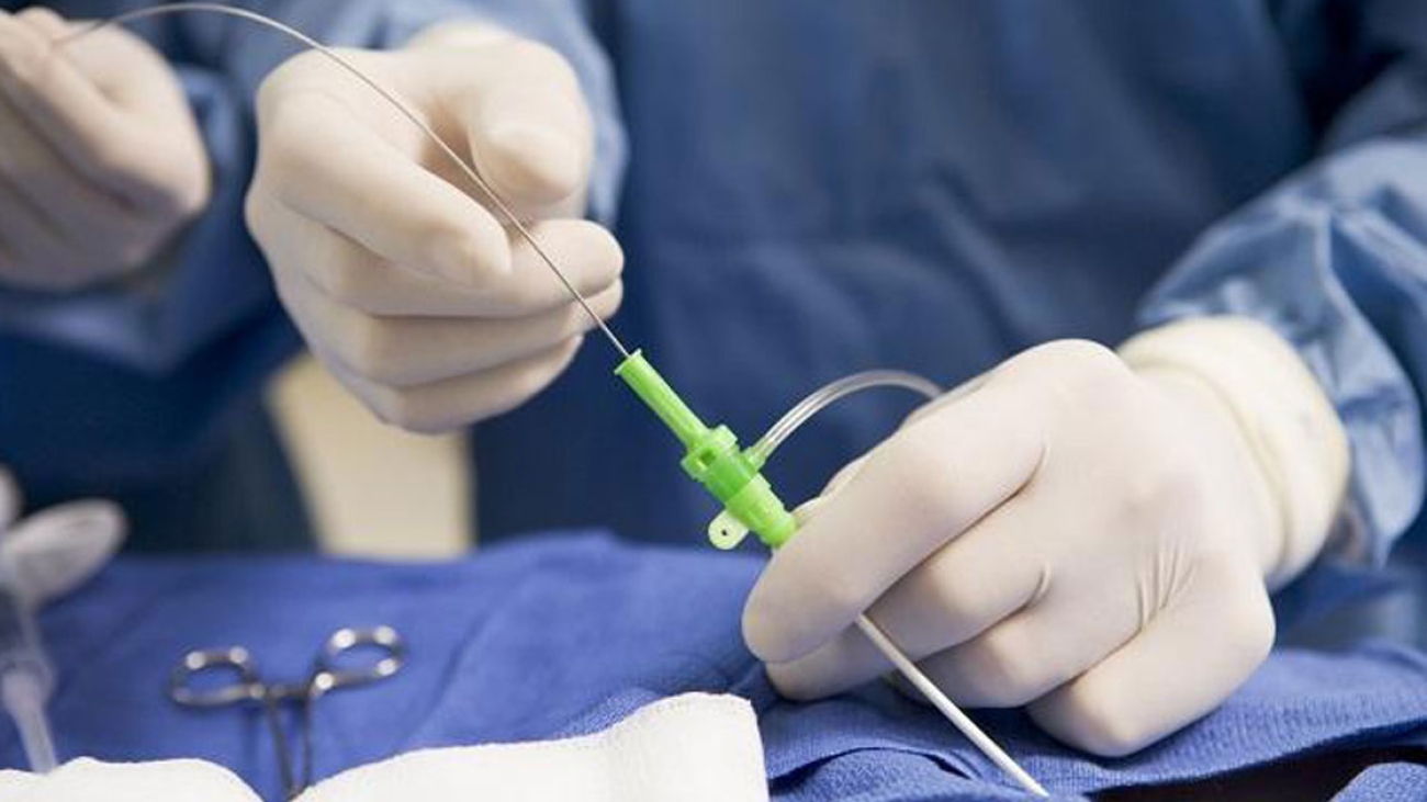 Interventional-Cardiology