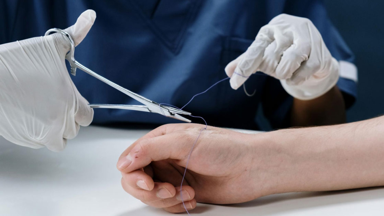 Sutures-Surgical